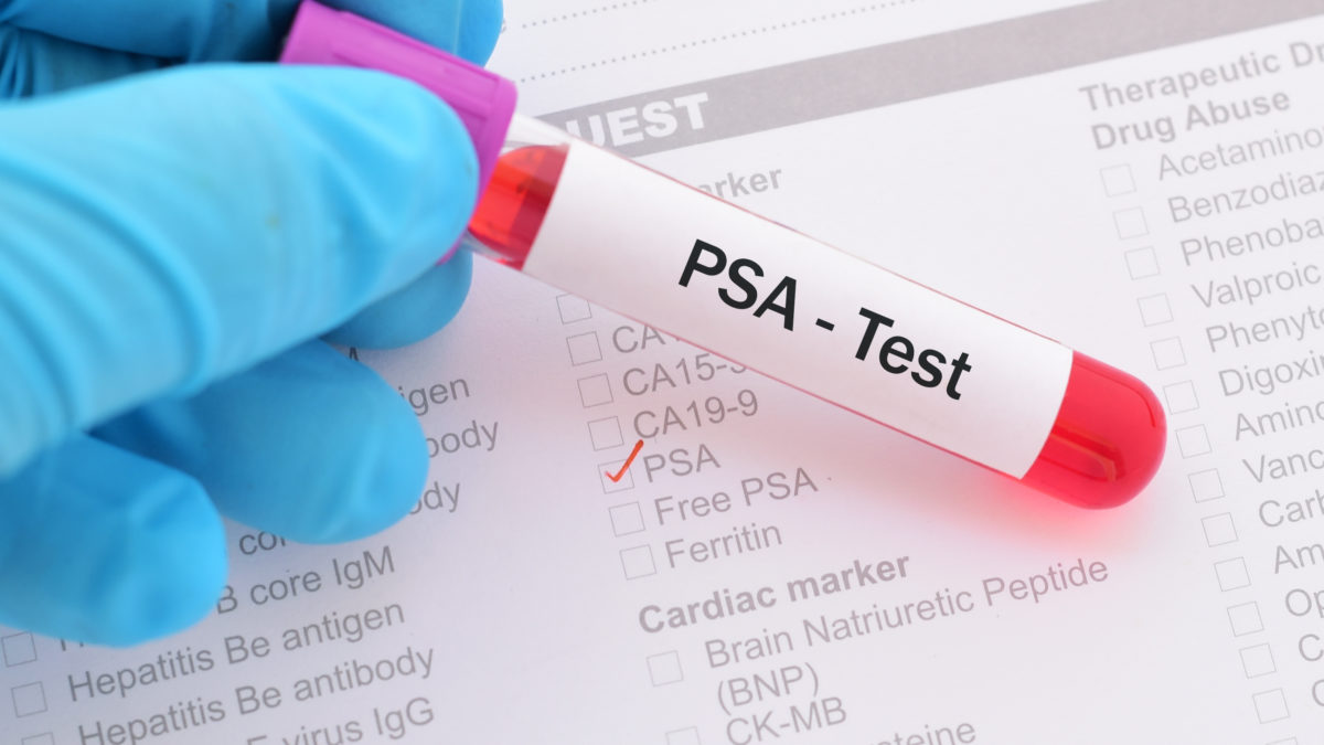 Le PSA - Dr Stéphane Adjiman